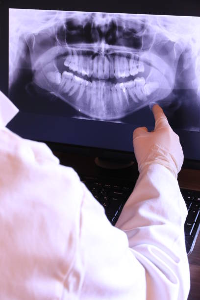 Best Emergency Treatment for Dental Infections or Abscesses in Lamar, MO