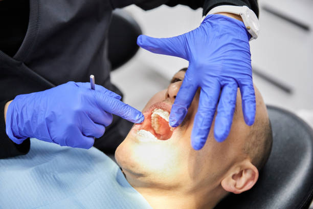 Best Emergency Dental Care for Broken or Chipped Teeth in Lamar, MO